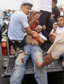 A protester wounded during a Bahraini military assault against protesters in February 2011
