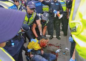 Police brutalize an anti-fascist activist in Melbourne, Australia
