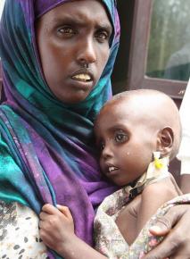 Somali woman holds her child while waiting for food aid in a refugee camp