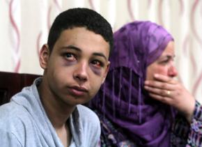 Tarek Abu Khdeir after his beating by Israeli police